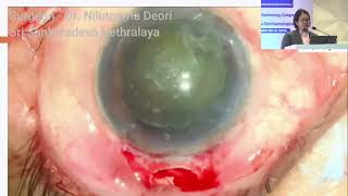 Aios2025 Gp142 T Dr Nilutparna Deori Dr Sahus 2Mm Msics Its Ergonomics