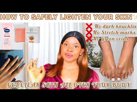 HOW TO SAFELY LIGHTEN YOUR SKIN: No Knuckles ,Green Veins + How To Get Clear Skin All Over Your Body