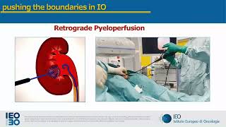 RSNA 2025 - Lunch Symposium Presentation - Angiography Franco Orsi 4D CT in IO