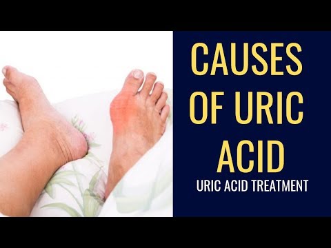 how-to-cure-uric-acid-permanently-|-uric-acid-diet-chart-2019