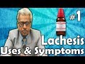 Lachesis Part 1 Uses And Symptoms In Homeopathy By Dr P S Tiwari Lachesis Part 1 Uses And Symptoms In Homeopathy By Dr P S Tiwari