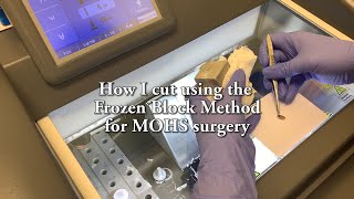 How a Histologic Technician cuts frozen tissue for cancer diagnosis (MOHS) in under 10 minutes!