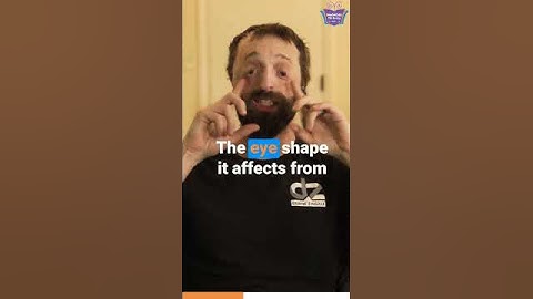 Intro to Duane and TC Syndrome