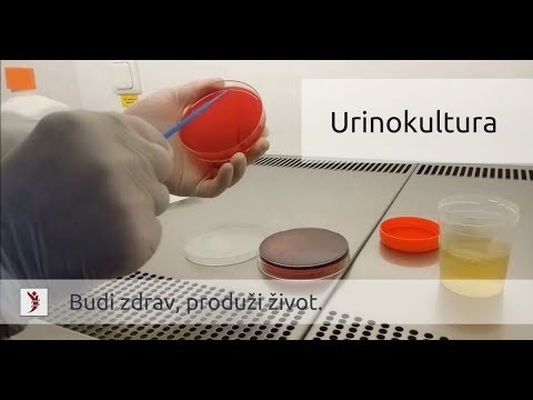 urinokultura