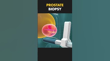 Transperineal Prostate Biopsy Explained! 🏥🔬 3D Animation