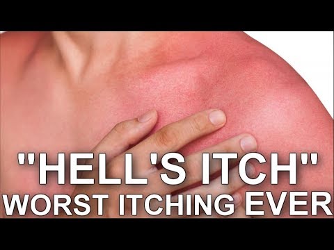 atarax for hells itch atarax for hells itch