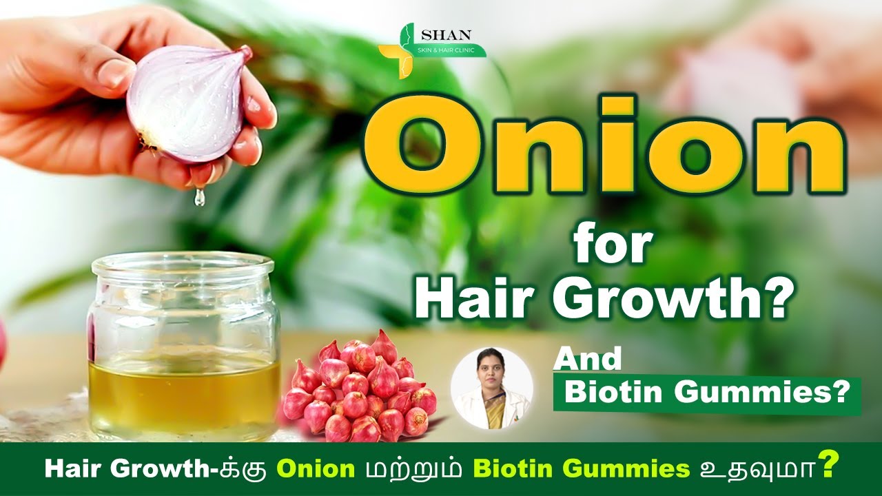 Hair Regrowth Trending | Onion & Biotin Gummies | shan skin and hair clinic | chennai | hosur