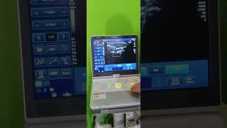 Toshiba Viamo ultrasound machine Linear probe scanning