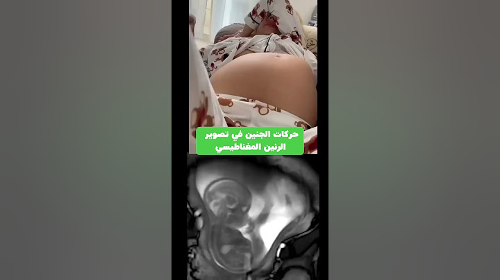 حركة الجنين داخل البطن خلال الحمل لمدة 9 أشهر