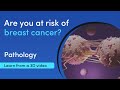 Who has a high risk of breast cancer  medimagic  3d