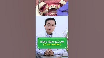 Niềng răng lâu quá có sao không? #nhakhoa #niengrang