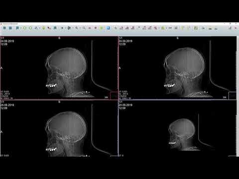 Как посмотреть запись исследования МРТ или КТ на диске