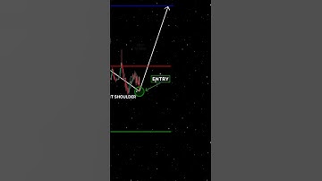 Trading 📊 #shorts #crypto #forex #trading #patterns