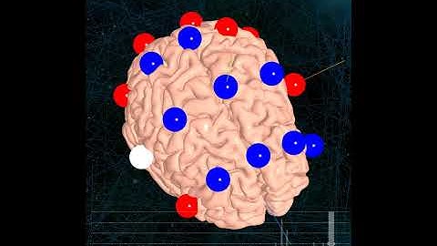 EEG Animation - 8 clusters