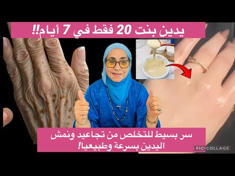 أيدي خالية من التجاعيد والنمش وأصغر ب10 سنين بسر ما يخطرش على البال
