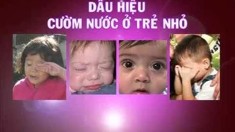 Glocom bẩm sinh: Bệnh nếu không phát hiện sớm dễ gây mù lòa