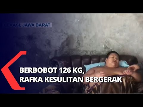 Rafka, Bocah Berusia 11 Tahun Berbobot 126 Kg Butuh Bantuan Medis!