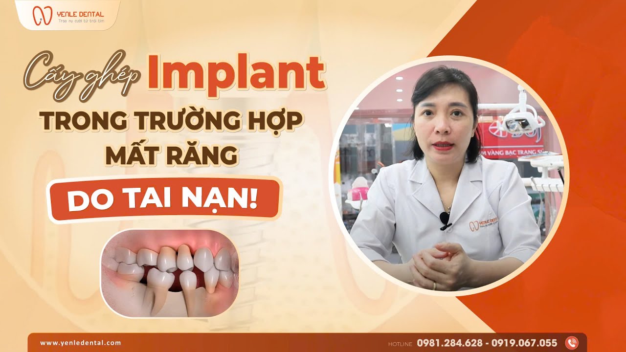 Nha Khoa Hải Phòng – Khôi Phục Răng Mất Do Tai Nạn Với Công Nghệ Cấy ...