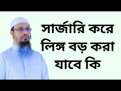 ভিডিও: আংটির আকার পরিবর্তন করা কি ব্যয়বহুল?