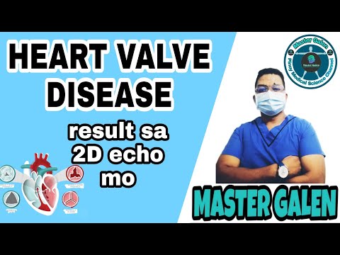 HEART VALVE DISEASE, PAANO GINAGAMOT. Valve Regurgitation, Valve Prolapsed