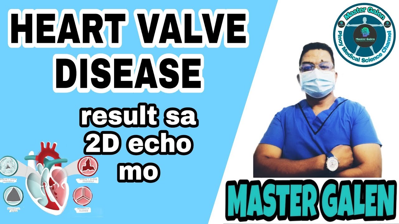 HEART VALVE DISEASE, PAANO GINAGAMOT. Valve Regurgitation, Valve Prolapsed