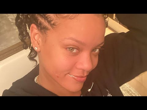 Rihanna Reacts To Fans Mocking Her Pimple Selfie