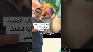 فيديو عملية دعامة الانتصاب