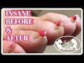 Pedicure Tutorial: Elderly Thick Toenails Growing Up Transformation