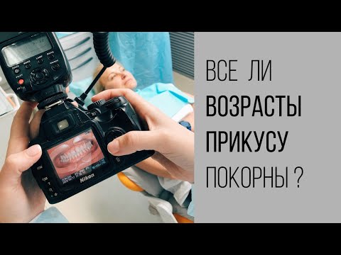 В каком возрасте лучше всего ставить брекеты?