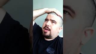 Após quimioterapia na veia caroço