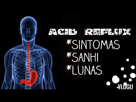 ACID REFLUX: Sintomas, Sanhi, Lunas