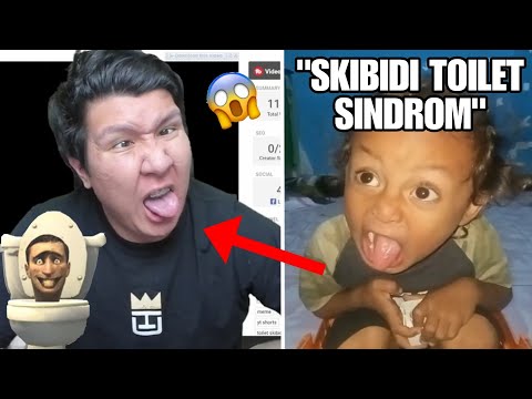 Windah Kena Sindrom