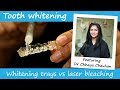 Professional teeth whitening trays vs laser whitening