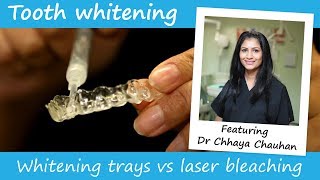 Professional teeth whitening trays vs laser whitening