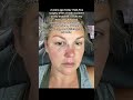 Overcoming Depression & Injury: Losing 56 lbs & Finding Strength Again