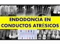 "ENDODONCIA EN CONDUCTOS ATRÉSICOS" por el Dr. Arturo Anzardo