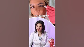 Spock Eyebrows after Botox Injection. What Should You Do?