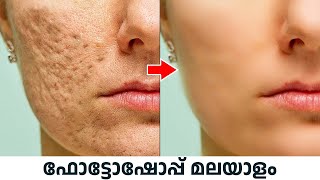 How to Clean Face in Photoshop Malayalam | Photoshop pimple removal Malayalam