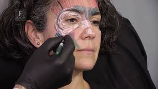 Module 1  Patient case Assessment  and Anatomy Drawings [CUT]