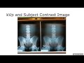 Contrast Overview 2024