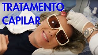 MEU TRATAMENTO CAPILAR PARA QUEDA DE CABELO | ANA HICKMANN