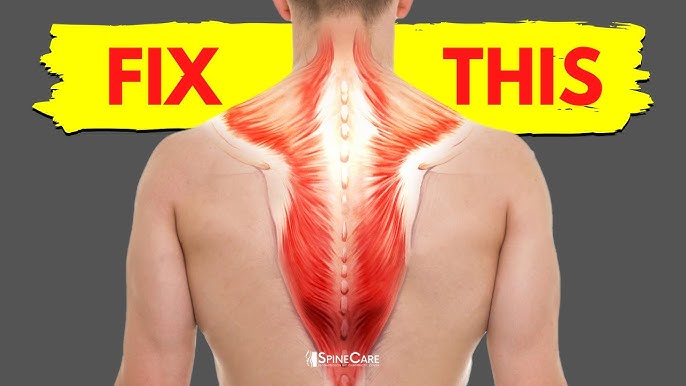 Neck, Shoulder & Mid-Back Pain Relief Stretches – South OC Chiropractic