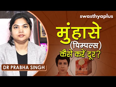 मुंहासे (पिम्पल्स) - कैसे करें दूर? | Dr Prabha Singh on How to Get Rid of Acne in Hindi | Pimples