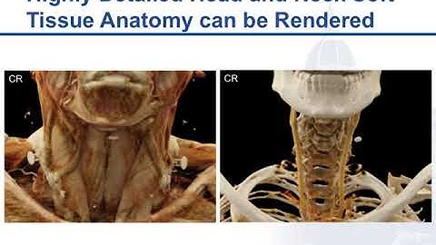 Cinematic Rendering: Principles, Applications, and Observations in CT Part 1