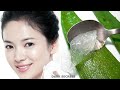 रात में Aloe Vera इस तरह लगालो की सुबह तक चेहरा इतना गोरा हो जायेगा / Get Spotless, Milky Fair skin