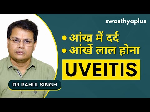 आंख का संक्रमण या यूवाइटिस क्या है? | Eye Disease Uveitis in Hindi | Treatment | Dr Rahul Singh