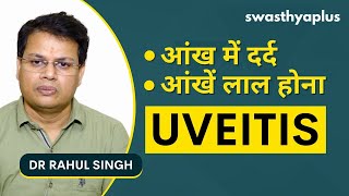 आंख का संक्रमण या यूवाइटिस क्या है? | Eye Disease Uveitis in Hindi | Treatment | Dr Rahul Singh