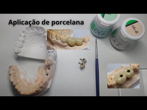 Vídeo: Quanto vale a minha porcelana Noritake?