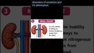 disorders of excretion and it's elimination #viral #shorts #neet