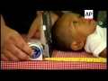 Filipino officially declared world's shortest man